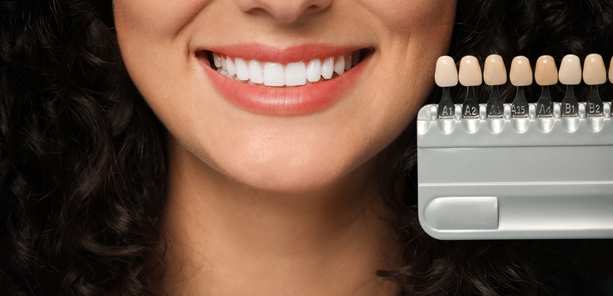 Porcelain Veneers: 7 Key Factors To Consider Before Your Smile Makeover