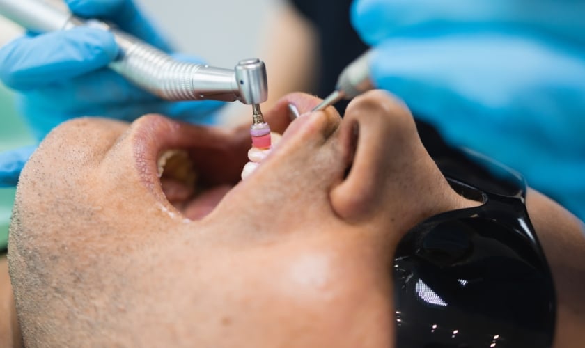 dental cleanings in nederland