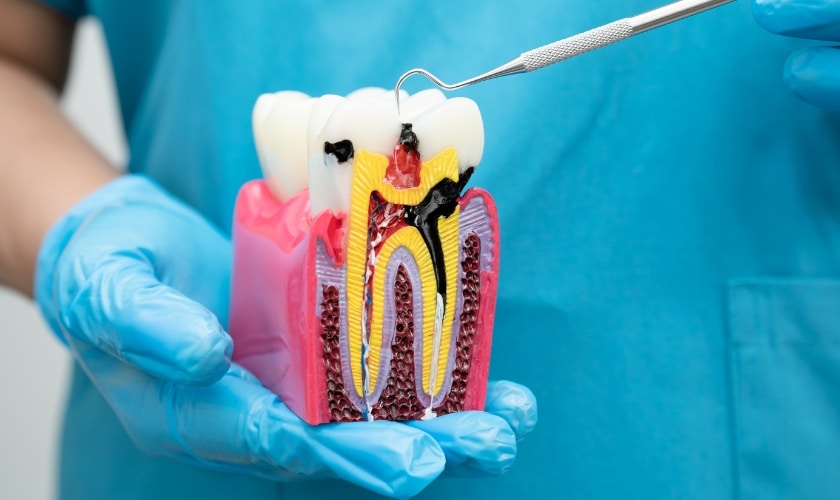 truth over fear modern root canals explained